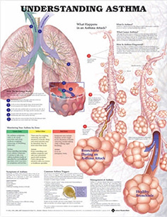 Anatomical Chart Company Unisex Understanding Asthma Anatomical Chart