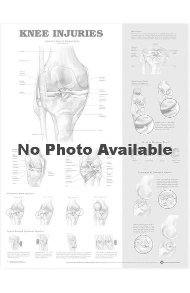 Anatomical Chart Company Knee Injuries Anatomical Chart Allheart