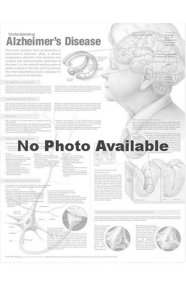 Anatomical Chart Company Understanding Alzheimer S Anatomical Chart