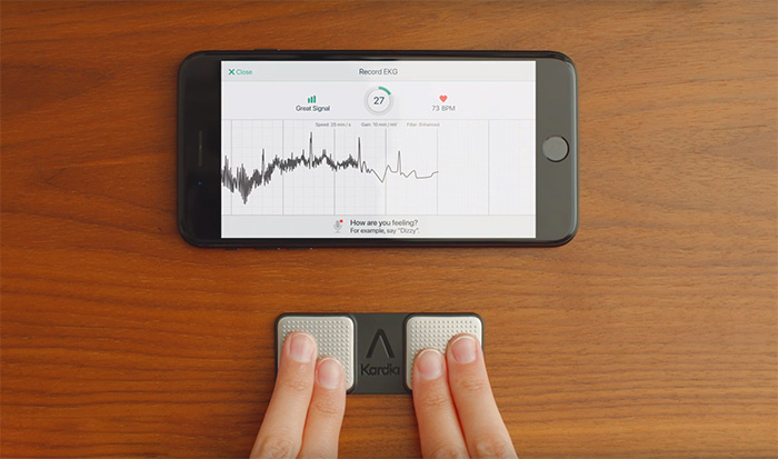 AliveCor KardiaMobile Personal EKG Monitor - Black