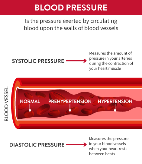 Blood pressure infographic showing types of pressure