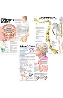 Anatomical Chart Company Neuroanatomy Head Model | allheart.com