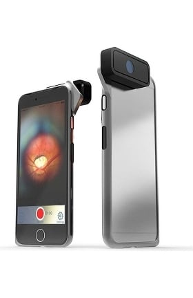 D-EYE Retinal Screening System For iPhone